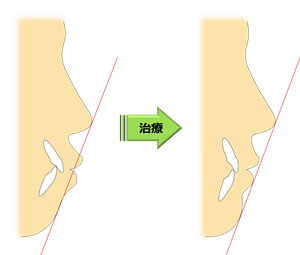 治療目標｜西岡矯正歯科医院