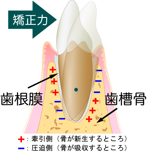 歯の移動